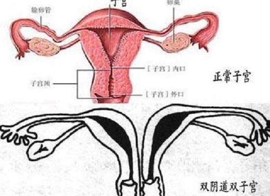 帶你了解什么是縱膈子宮，別再和雙子宮搞混了