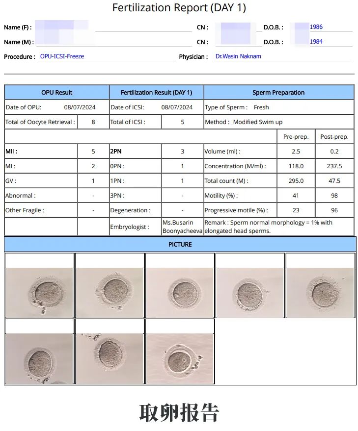 取卵報告