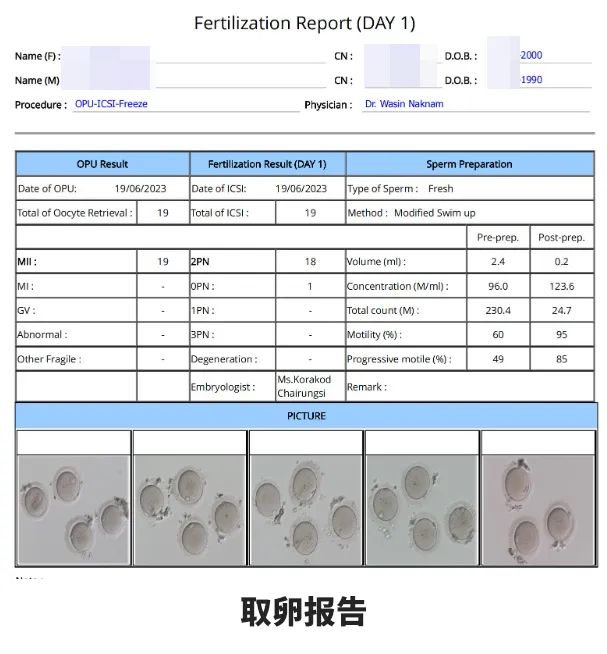 取卵報(bào)告